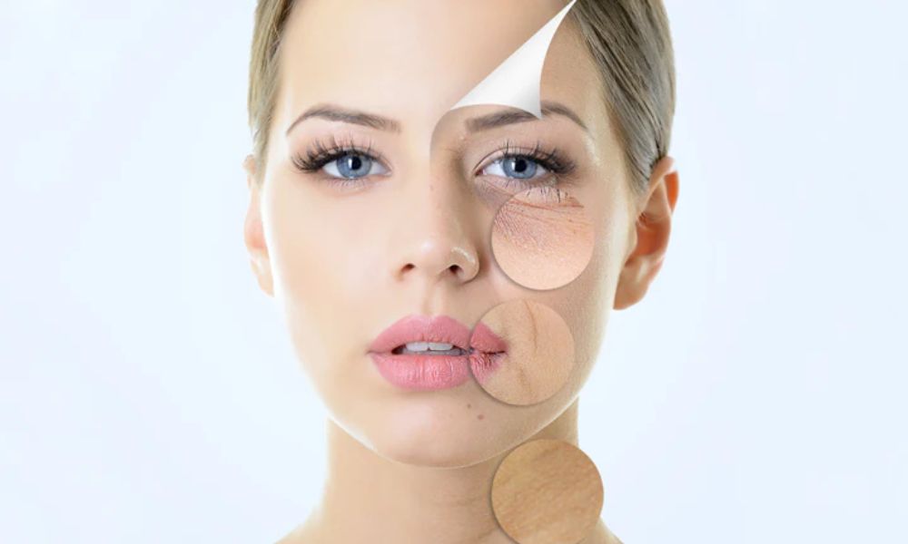 Facial Rejuvenation Techniques and Treatments Explained